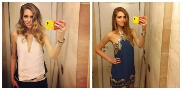 好看的手机壳推荐明星同款,明星们都用的手机壳超少女