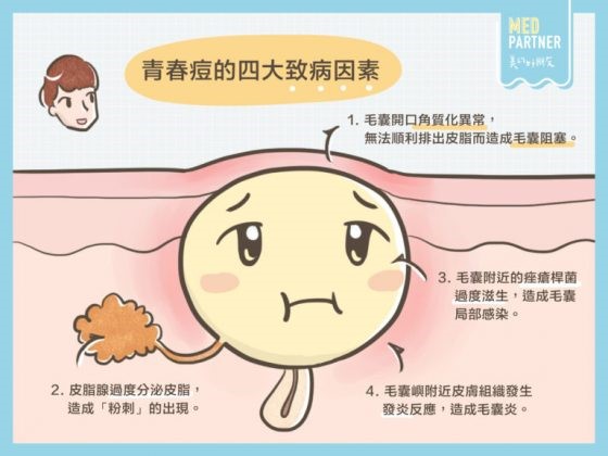 战痘100种祛痘方法,长痘治疗攻略