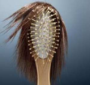 这五大治疗脱发的方法你居然还不知道？