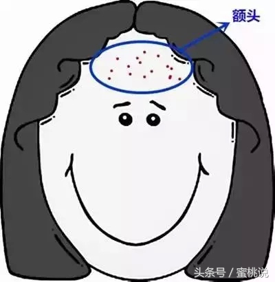 12岁脸上长痘按什么穴位,各个部位长痘原因太阳穴