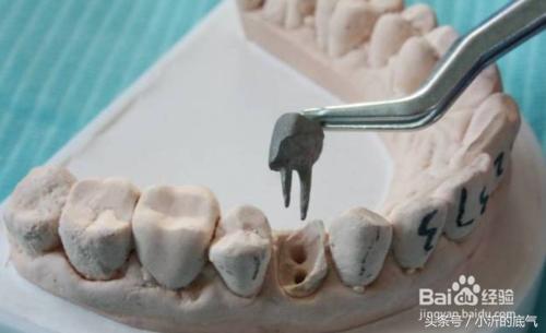 为什么乳牙残根一定要拔掉？一定不能留！