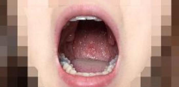 口中异味口臭怎么治疗,口中气味重又有口臭怎么办