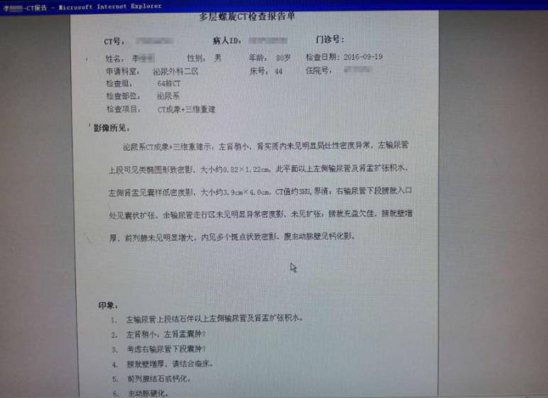 23岁男性泌尿道结石治疗方法,中医治疗输尿管结石独特方法