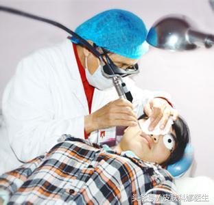 孩子脸上的痦子需要点掉吗,长在脸上的痦子图片大全