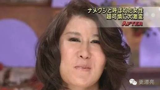 日本整形与韩国整形对比,为什么日本整形不如韩国整形