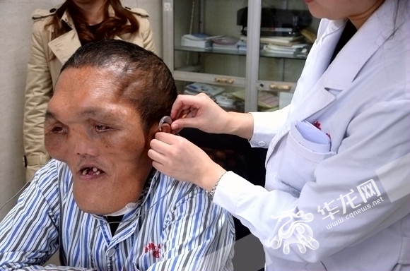 男子怪病困扰二十年,男子被怪病困扰十多年