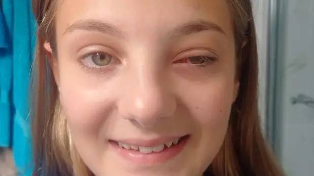 坑爹！加拿大女孩视网膜脱落保险公司：还有视力，只赔8元路费！