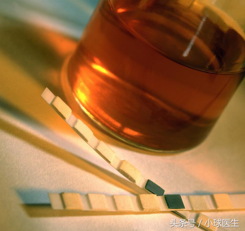 如何留取尿液标本，看了就知道！
