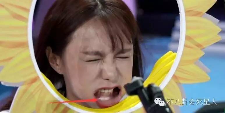 沈梦辰整下巴,沈梦辰有没有整下颚角