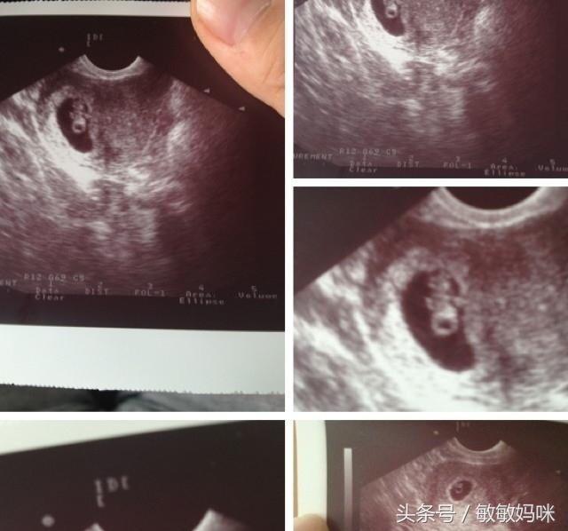 怀孕12周后仍需警惕,怀孕12周夫妻注意事项