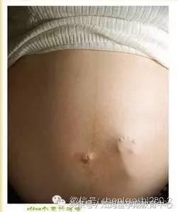 孕期怎么分辨假性宫缩,孕期胎动怎样辨别好坏