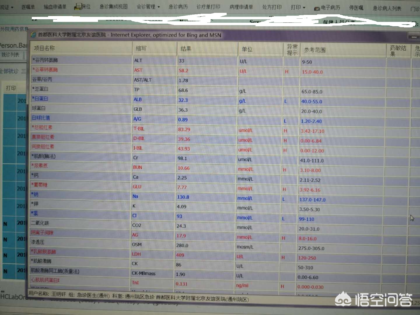 黄疸的分类和特点,黄疸的分类特点
