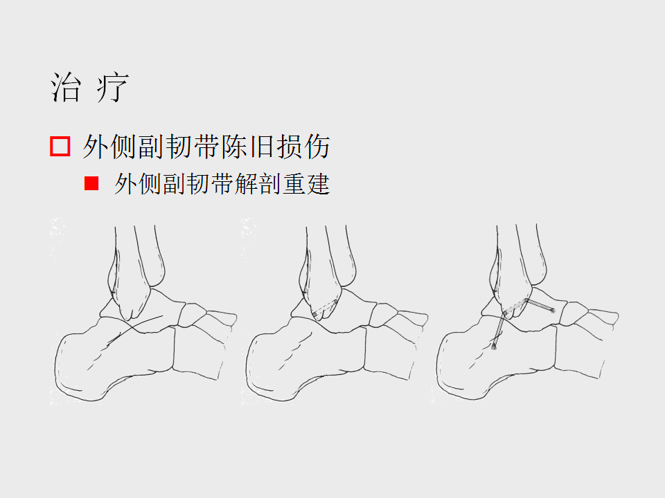 脚崴了怎么办判断是否骨折,脚崴了怎么办视频