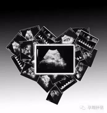 教你看懂b超单粉色蓝色,一招教你读懂b超单