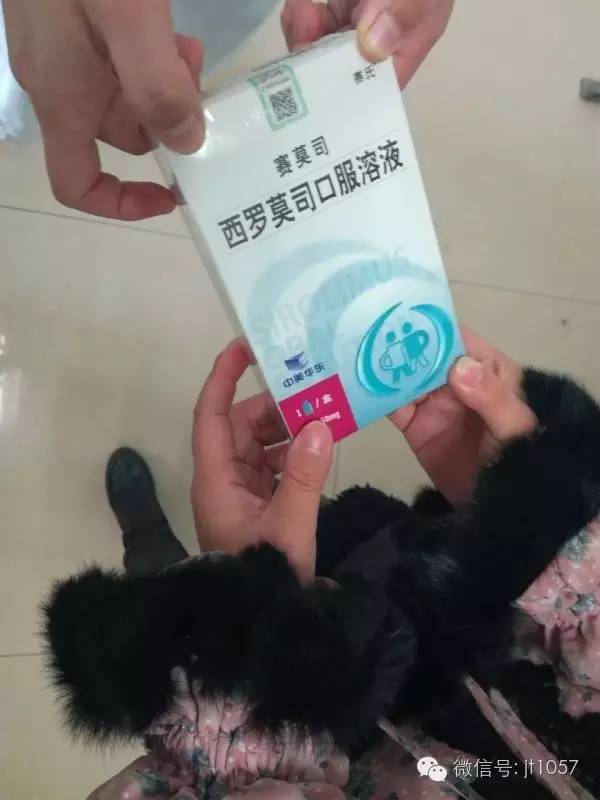 女婴出生26天得罕见病,维吾尔族女婴