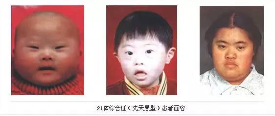 捏宝宝鼻子能捏出高鼻梁吗,宝宝老是擦鼻子擦眼睛