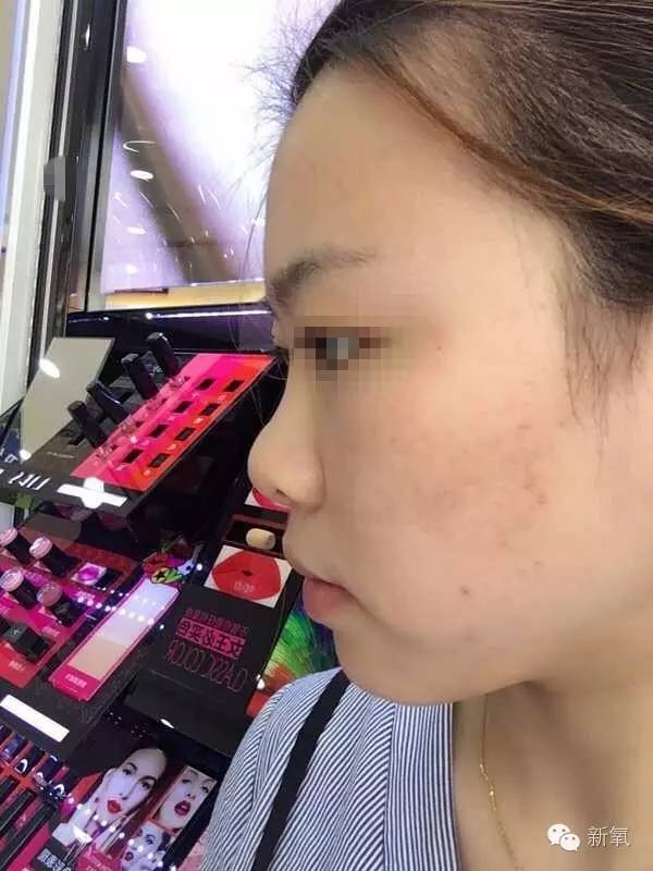 林允是不是整鼻子了,林允隆鼻过吗