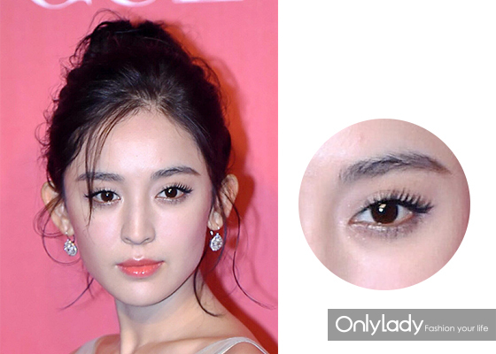 女子花4万块整容把嘴都整歪了,美国女子花76万整容