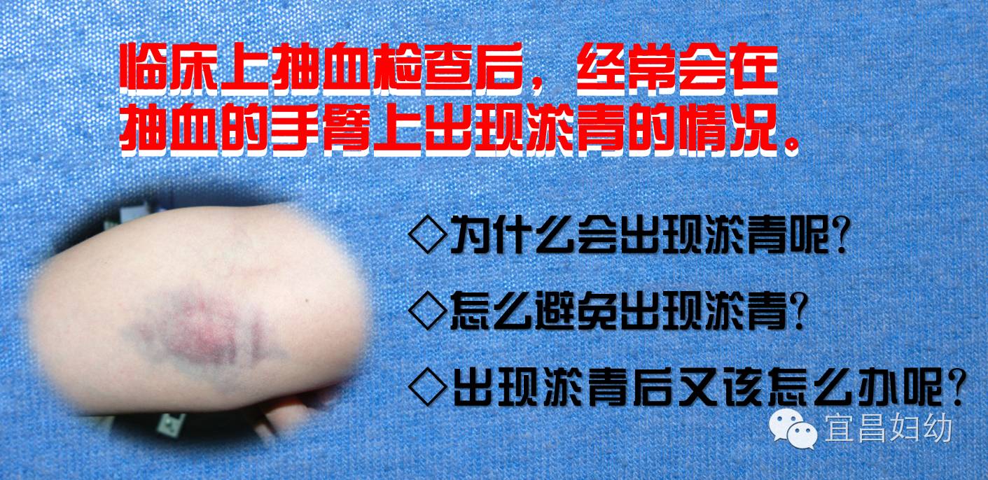 抽血后手臂淤青健身,验血后手臂一直淤青有事吗