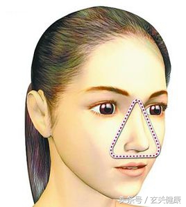 长痘不要挤，“危险三角区”容易引起颅内感染