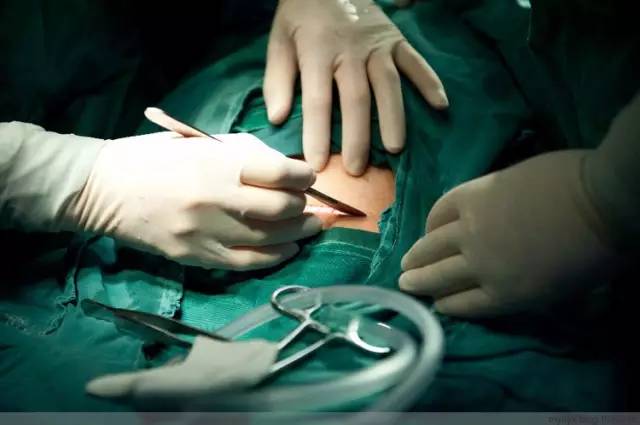 剖腹产恢复很好的照片,剖腹产完全恢复照片