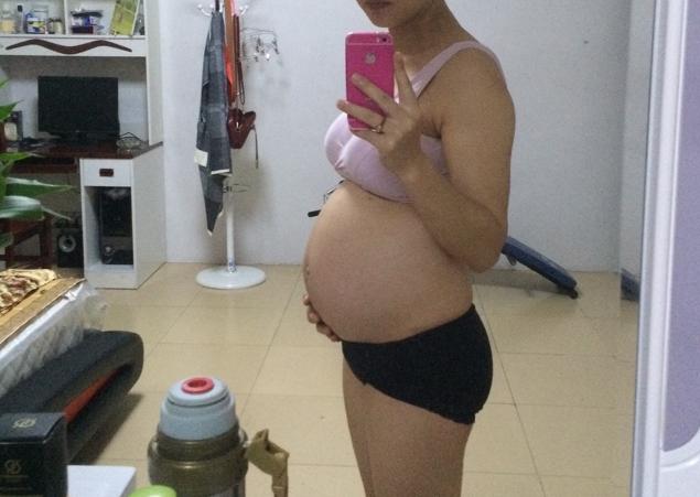 23周四维结果绕颈一圈怎么办,23周6天四维