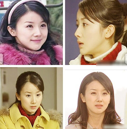 整容保质期大概多久,明星整容一般多久恢复