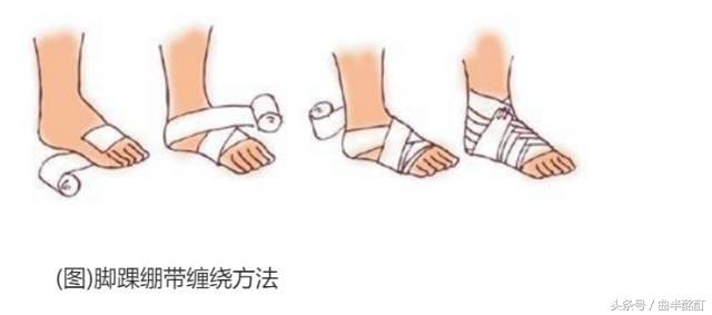 科普足踝扭伤防治,踝关节扭伤处理视频