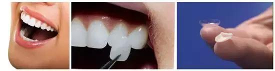 为什么明星的牙齿那么白那么整齐,为什么明星抽烟牙齿还那么白