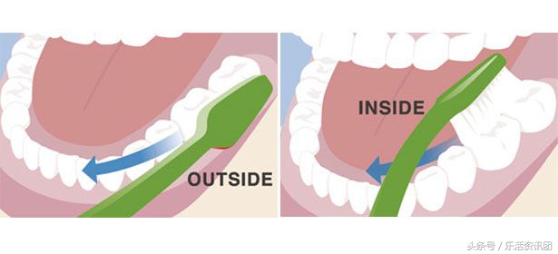儿童电动牙刷正确刷牙方法示范,电动牙刷的正确刷牙方法飞利浦