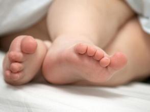 孩子x型腿怎么矫正,孩子x型腿怎么改善