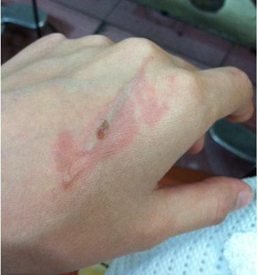 小时候的调皮后果,小时候调皮捣蛋的经历