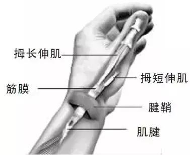 玩手机玩得大拇指痛怎么办,手机玩多了手指肿痛