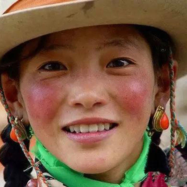 红血丝敏感肌知识,红血丝小妙招