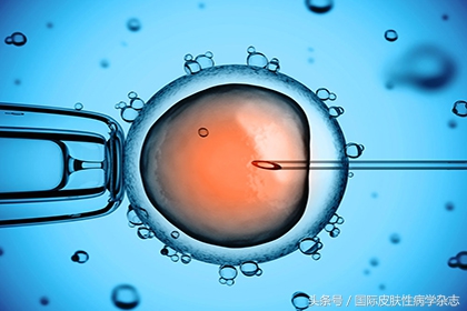 移植物抗宿主病是什么意思 (输血相关性移植物抗宿主病)