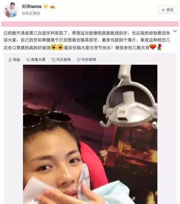 整牙刘涛,整牙改变脸型杨幂