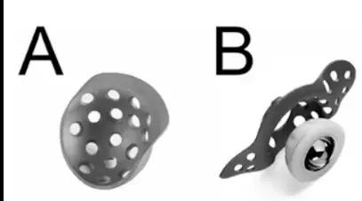 髋臼骨质破坏一般怎么治,髋臼骨缺损