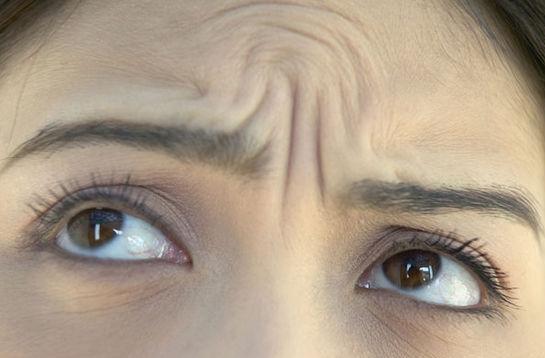 除皱选择点阵激光剥脱与非剥脱,一直做激光除皱会有副作用吗