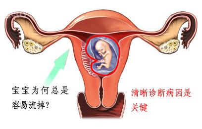 孕33周后注意事项,孕33周以后注意事项有哪些