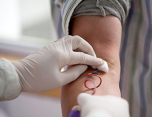 三院科普丨Zzz~打呼噜的“照妖镜”有哪些?