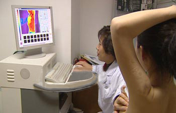 乳腺增生加囊肿的癌变几率和时间,乳腺导管上皮增生癌变几率