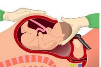 旧社会碰到难产怎么办,古代难产挤压肚子安胎