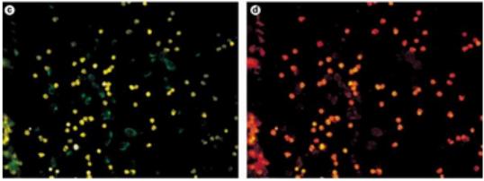 肿瘤细胞的清除,肿瘤细胞清除靠的是什么免疫