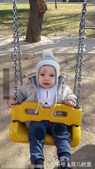 刚出生的婴儿额头有大块红色胎记,妈妈看一眼后竟热泪盈眶!