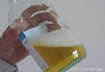 尿频、尿血、泡沫多,身体里这个地方需要“好好维修”了!