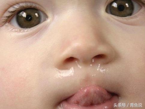孩子流鼻涕怎么看是风热还是风寒,妈妈必须知道孩子流鼻涕的原因