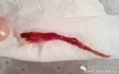 准妈去医院验孕用的是哪种方法？这些方法你可能听都没听过！