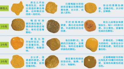 婴儿大便墨绿色是吓到了吗,为什么一个多月的宝宝大便有点黑