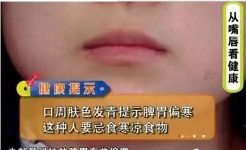 嘴唇上有几种颜色是什么病,嘴唇肿要警惕四种慢性病