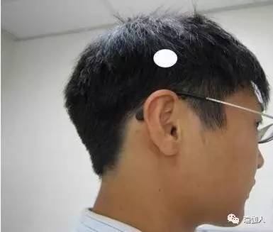 减肥按哪些穴位效果事半功倍,常按穴位到底可以治病吗